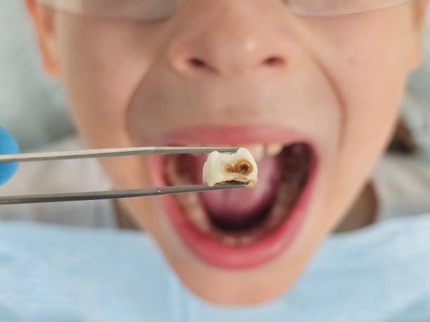 Best Tooth Pain Emergency Relief  in Fremont, IN